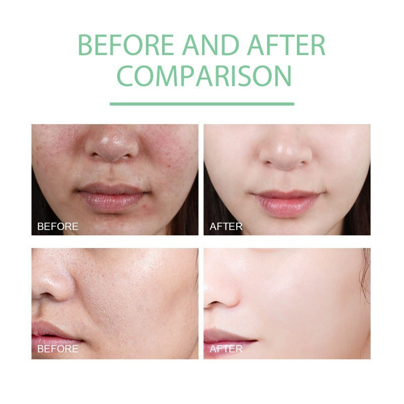Herbal Exfoliating Gel Gently Cleans